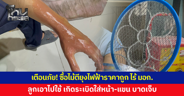 เตือนภัย! ซื้อไม้ตียุงไฟฟ้าราคาถูก ลูกเอาไปใช้ ระเบิดใส่หน้า-แขน บาดเจ็บ