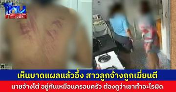 เห็นแผลแล้วอึ้ง สาวลูกจ้างถูกตีจนมีบาดแผลทั่วตัว นายจ้างโต้ เราดูแลเขาเหมือนคนในครอบครัว ผิดก็ต้องสอน