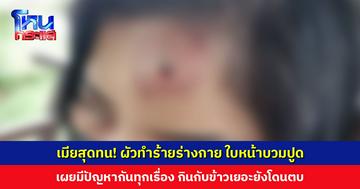 เมียสุดทน! ผัวทำร้ายร่างกาย ใบหน้าบวมปูด เผยมีปัญหากันทุกเรื่อง แม้แต่เรื่องกินกับข้าวเยอะยังโดนตบ