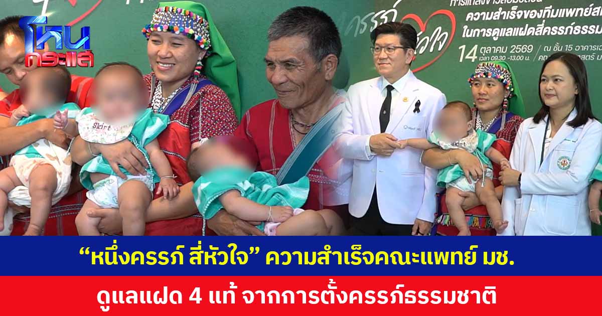 ครั้งแรกของไทย! “หนึ่งครรภ์ สี่หัวใจ” ความสำเร็จของคณะแพทย์ มช. ในการดูแล “แฝด 4 แท้” จากไข่ใบเดียวกัน โดยการตั้งครรภ์ตามธรรมชาติ