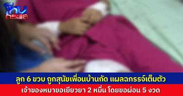 แม่เด็กร้องเพจ ลูก 6 ขวบ ถูกสุนัขเพื่อนบ้านกัด แผลฉกรรจ์ทั่วร่างกาย เจ้าของหมาเยียวยา 2 หมื่น ขอผ่อน 5 งวด