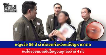 หญิงวัย 56 ปี ผ่าตัดยกคิ้ว แต่ได้รอยแผลเป็นใหญ่จนถูกล้อว่ามี 4 คิ้ว หมอบ่ายเบี่ยง ไล่ไปเลเซอร์เอง