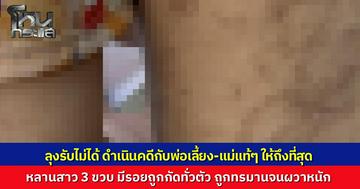 ลุงสุดเดือด รับหลาน 3 ขวบกลับบ้าน พบรอยกัดเต็มตัว เชื่อฝีมือพ่อเลี้ยง ทำร้ายเด็กสุดทารุณจนน้องผวาหนัก แม่แท้ๆ หนีไปกับพ่อเลี้ยง ลุงลั่นต้องเอาเข้าคุกทั้งผัวทั้งเมีย!
