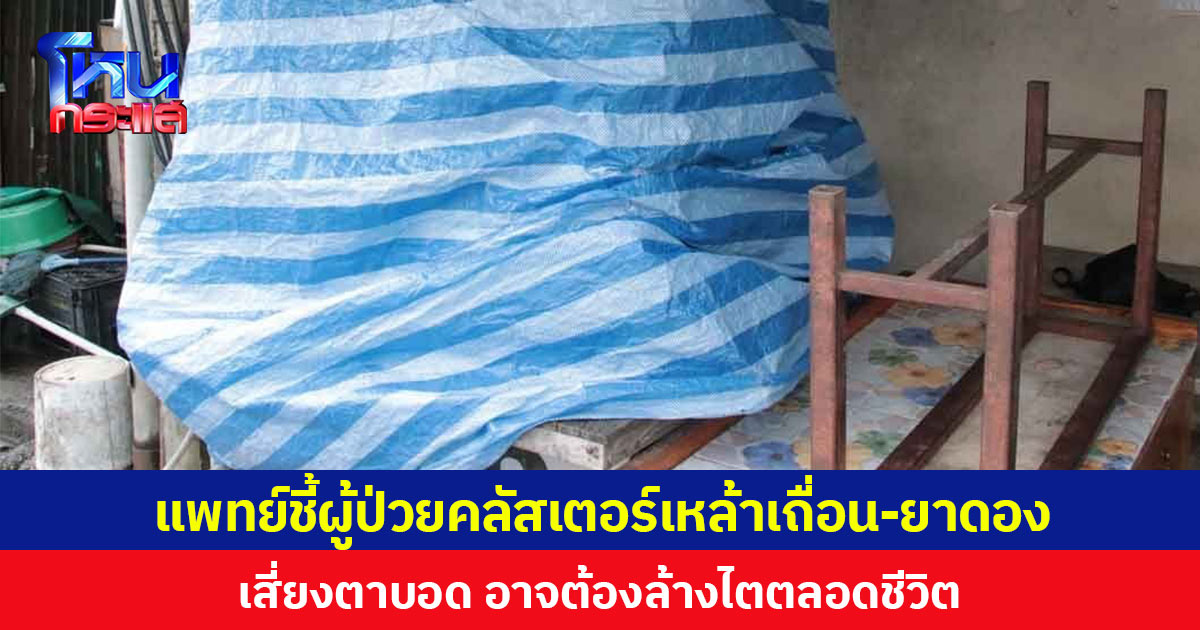 กรมการแพทย์เผยผู้ป่วยคลัสเตอร์เหล้าเถื่อนผสมเมทานอล บางรายตาพร่ามัว เสี่ยงต้องล้างไตตลอดชีวิต