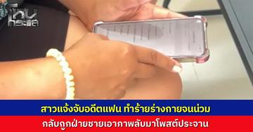 สาวบุรีรัมย์ ถูกแฟนหนุ่มซ้อมน่วม ถูกแทงนิ้วจนต้องดามเหล็ก หนีตายไปแจ้งความ กลับถูกฝ่ายชายโพสต์ภาพลับประจาน