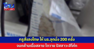 นักเรียนส่งการบ้านไม่ตรงเวลา ถูกครูสั่งลงโทษ ให้ลุกนั่ง 200 ครั้ง จนกล้ามเนื้อสลาย ไตวาย 