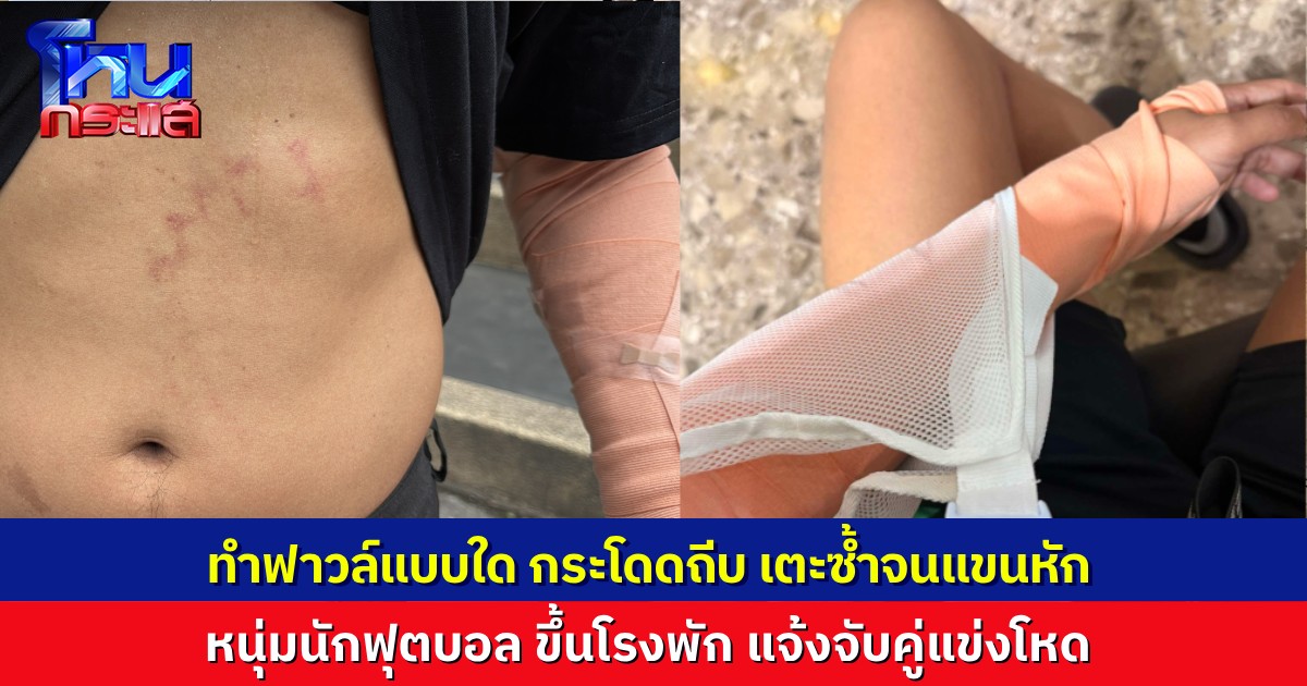 หนุ่มนักฟุตบอลแจ้งความ หลังถูกคู่แข่งเล่นนอกเกม ทำฟาวล์รุนแรง กระโดดถีบยอดอก เตะจนแขนหัก ระหว่างแข่งบอลเดินสาย 7 คน