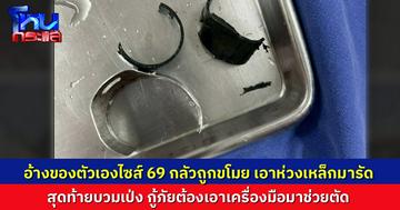 อืม..หนุ่มบุรีรัมย์ เอาห่วงเหล็กรัด “ของลับ ขนาด 69” อ้างกลัวถูกขโมย  กู้ภัยต้องใช้เครื่องมือตัดช่วย