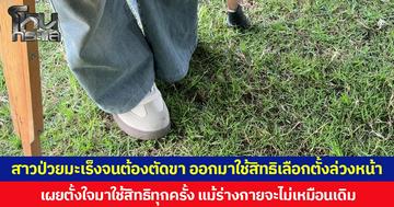 สาวป่วยมะเร็งจนต้องตัดขา ออกมาใช้สิทธิเลือกตั้งล่วงหน้า เผยตั้งใจมาใช้สิทธิทุกครั้ง แม้ร่างกายจะไม่เหมือนเดิม