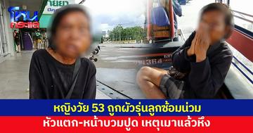 หญิงวัย 53 ถูกผัวรุ่นลูกซ้อมน่วม หัวแตก-หน้าบวมปูด เหตุเมาแล้วหึง ชาวบ้านสงสาร แจ้งจนท.ช่วย