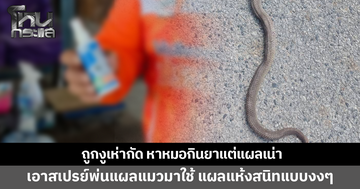 ชายวัย 55 ถูกงูเห่ากัดนิ้วเท้า หาหมอกินยาแต่แผลเน่า ลองเอาสเปรย์พ่นแผลแมวมาใช้ แผลแห้งสนิท