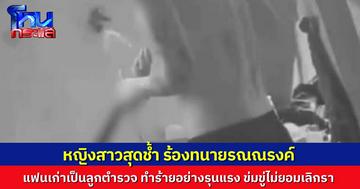 หญิงสาวร้อง มูลนิธิทนายรณณรงค์ ถูกแฟนเก่าลูกนายตำรวจทำร้าย ซ้ำขู่คุกคามไม่หยุด