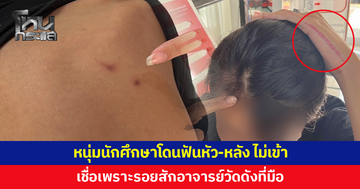หนุ่มนักศึกษาโชว์ของดี รอยสักอาจารย์วัดดังที่มือ โดนคู่กรณีฟันหัว-หลัง ไม่เข้า