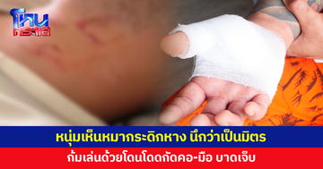 อุทาหรณ์ หนุ่มไปซื้อยำ เห็นหมากระดิกหางใส่ นึกว่าเป็นมิตร ก้มเล่นด้วยโดนกระโดดกัดคอ-มือบาดเจ็บ เพื่อนเข้าช่วยโดนด้วย หามส่ง รพ.คู่
