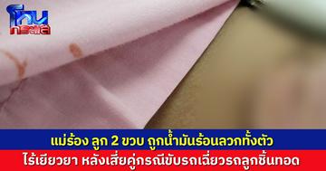 แม่สุดช้ำ เสี่ยขับรถเฉี่ยวรถลูกชิ้นทอด ทำน้ำมันลวกลูก 2 ขวบทั้งตัว เจ็บสาหัส ไร้เยียวยา