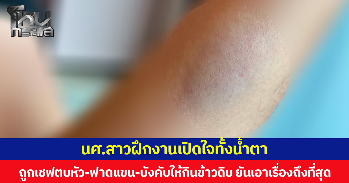 นศ.สาวฝึกงานเปิดใจทั้งน้ำตา ถูกเชฟตบหัว-ฟาดแขน-บังคับให้กินข้าวดิบ ยันเอาเรื่องถึงที่สุด