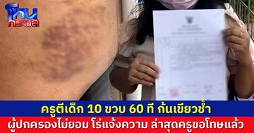 แจ้งความครูตีเด็ก 10 ขวบ 60 ที ก้นเขียวช้ำ ลงโทษเหตุไม่ยอมนั่ง ล่าสุดครูรับผิด ขอโทษแล้ว