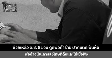 ช่วยเหลือเด็กชาย 8 ขวบ ถูกพ่อทำร้าย ตัวช้ำ ปากแตก ฟันหัก พ่ออ้างเป็นการลงโทษที่ไม่เชื่อฟัง