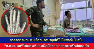 ทหารชุดลาดตระเวนชายแดนละหานทราย ดึงเชือกปริศนาซุกใต้ใบไม้ ก่อนบึ้มสนั่น "ส.อ.ธนพล" โดนสะเก็ดระเบิดนิ้วขาด ล่าสุดผ่าตัดปลอดภัยแล้ว