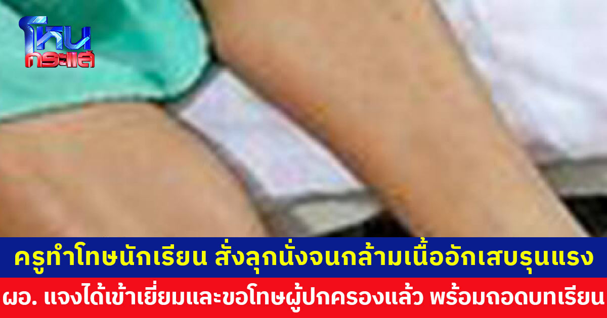 ครูสั่งนักเรียนลุกนั่ง 150 ครั้ง จนกล้ามเนื้ออักเสบรุนแรง นอน รพ. 7 วัน ผอ. แจงครูทำเพราะเคี่ยวเข็ญเรื่องเรียน ได้ไปเยี่ยมเด็กและขอโทษผู้ปกครองแล้ว