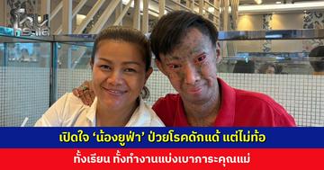 เปิดใจ ‘น้องยูฟ่า’ ป่วยโรคดักแด้ แต่ไม่ท้อ ทั้งเรียน ทั้งทำงานแบ่งเบาภาระคุณแม่