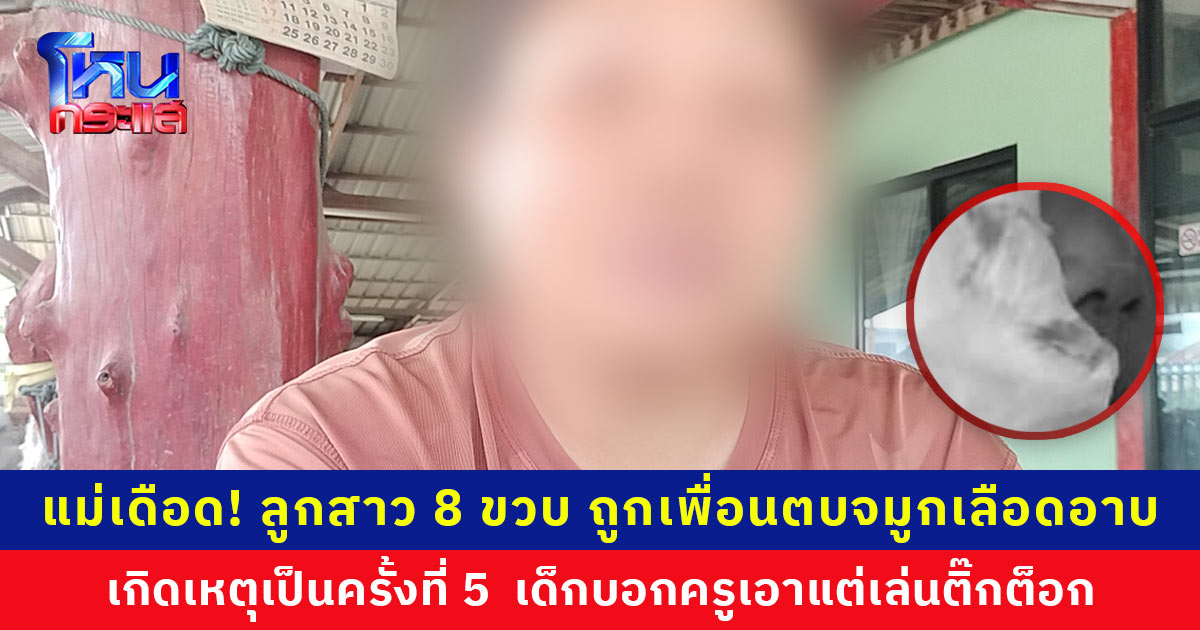 แม่เดือด! ลูกสาววัย 8 ขวบ ถูกเพื่อนตบจมูกเลือดอาบ โดนมา 5 ครั้ง ผอ. รับปากจะดูแล ทั้งชั้นมีนักเรียนแค่ 8 คน แต่ก็ยังเกิดเหตุซ้ำ เด็กเผยครูเอาแต่เล่นติ๊กต็อก
