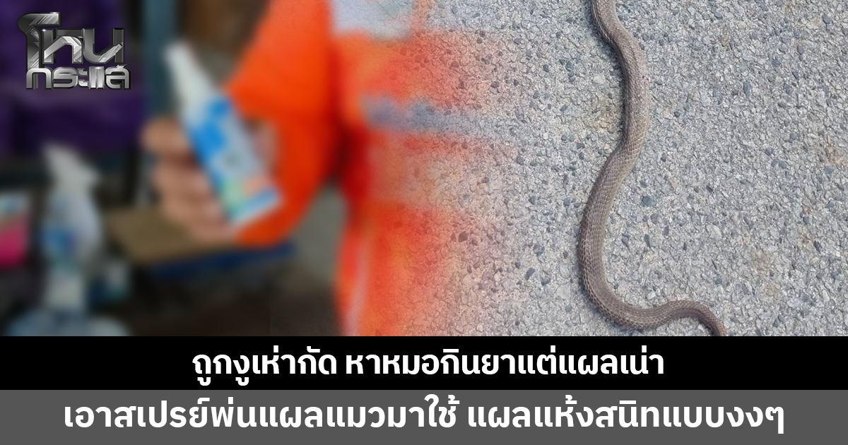 ชายวัย 55 ถูกงูเห่ากัดนิ้วเท้า หาหมอกินยาแต่แผลเน่า ลองเอาสเปรย์พ่นแผลแมวมาใช้ แผลแห้งสนิท