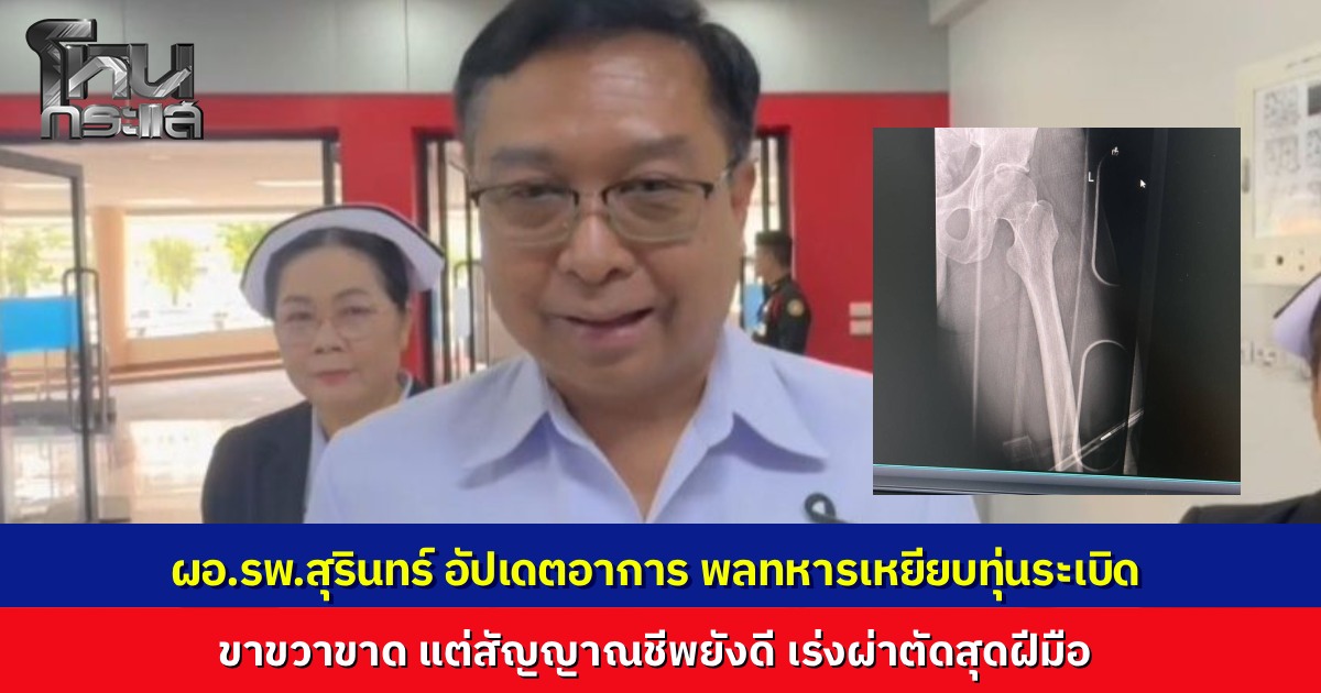 ผอ.รพ.สุรินทร์ เผยอาการ "พลทหารเดชศักดิ์" เหยียบกับระเบิดที่ฐานเอราวัณ ขาขวาขาด สัญญาณชีพดี เตรียมผ่าตัดรักษาอย่างเร่งด่วน