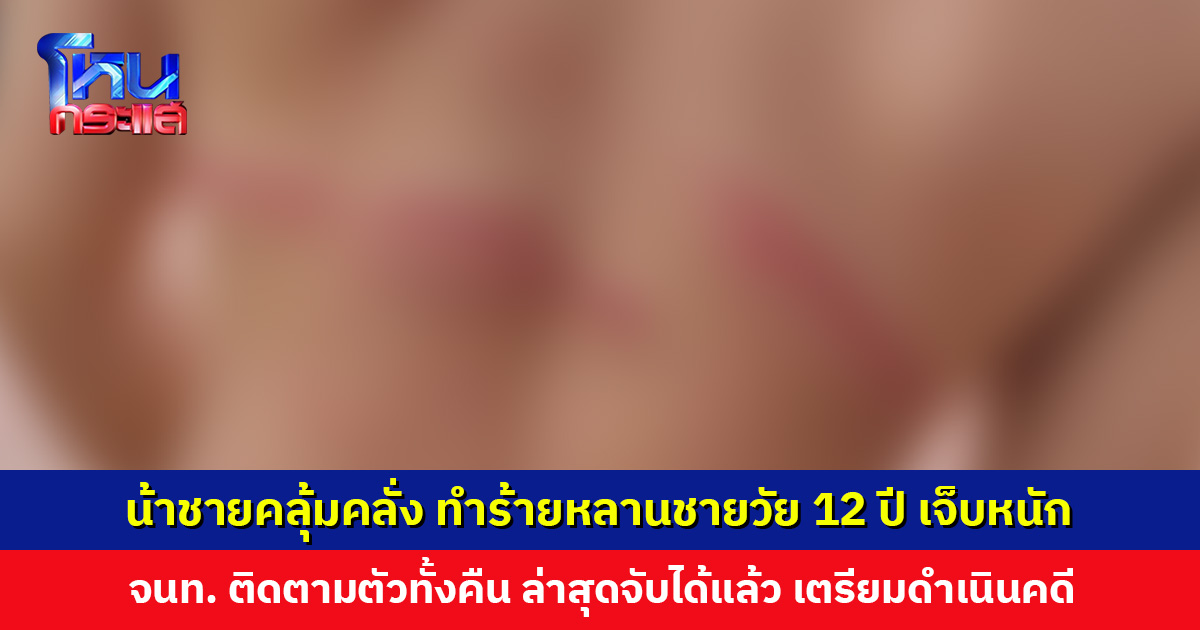 น้าชายคลุ้มคลั่ง ทำร้ายหลานชายวัย 12 ปี เจ็บหนัก เจ้าหน้าที่เตรียมดำเนินคดี
