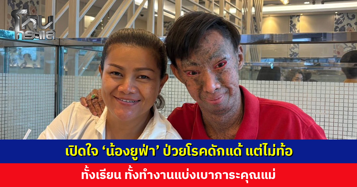 เปิดใจ ‘น้องยูฟ่า’ ป่วยโรคดักแด้ แต่ไม่ท้อ ทั้งเรียน ทั้งทำงานแบ่งเบาภาระคุณแม่