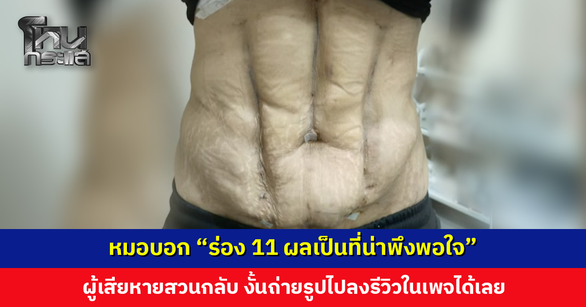 หมอบอก “ร่อง 11 ผลเป็นที่น่าพึงพอใจ” ผู้เสียหายสวนกลับ บอกให้ถ่ายภาพแล้วเอาไปลงรีวิวได้เลย