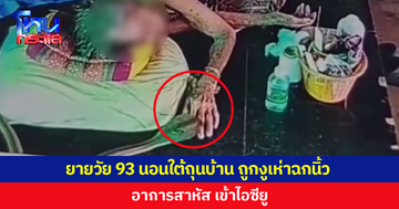 ยายวัย 93 นอนใต้ถุนบ้าน ถูกงูเห่าเลื้อยฉกนิ้วมือ