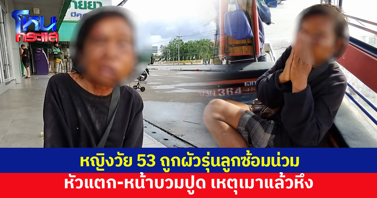 หญิงวัย 53 ถูกผัวรุ่นลูกซ้อมน่วม หัวแตก-หน้าบวมปูด เหตุเมาแล้วหึง ชาวบ้านสงสาร แจ้งจนท.ช่วย
