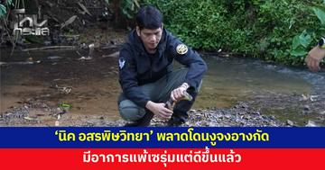 'นิค อสรพิษวิทยา' พลาดโดนงูจงอางกัดจมเขี้ยว