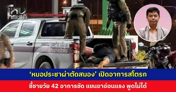 ‘หมอประชาผ่าตัดสมอง’ เปิดอาการสโตรก ชี้ชายวัย 42 อาการชัด แขนขาอ่อนแรง พูดไม่ได้