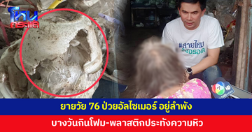 ยายวัย 76 ป่วยอัลไซเมอร์ อยู่ลำพัง บางวันกินโฟม-พลาสติกประทังความหิว