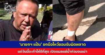 ‘นายกฯ แป้น’ ยกมือไหว้ยอมรับผิดพลาด อัปเดตการเยียวยา ปชช.-การจัดการจัดขยะ ย้ำจะทำให้ดีที่สุด เปิดแผลแช่น้ำท่วมจนเน่า