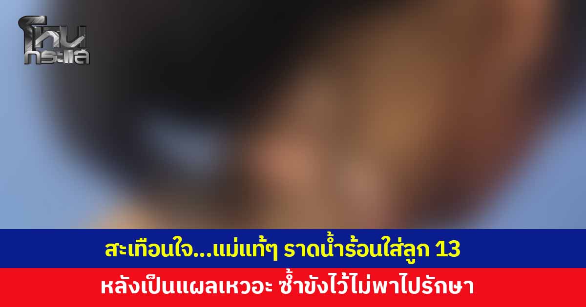 แม่แท้ๆ ใช้น้ำร้อนราดใส่ลูกสาว 13 หลังเป็นแผลเหวอะหวะ ซ้ำขังไว้ไม่พาไปรักษา ล่าสุดหน่วยงานเข้าช่วยเหลือ พบมีพฤติกรรมทำร้ายลูกเป็นประจำ 