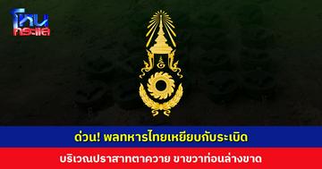 พลทหารไทยเหยียบกับระเบิด บริเวณปราสาทตาควาย ได้รับบาดเจ็บขาขวาท่อนล่างขาด
