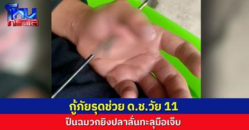 อุทาหรณ์ ด.ช.วัย 11 พลาดทำปืนฉมวกยิงปลาลั่นทะลุมือเจ็บ กู้ภัยเร่งหามส่งรพ.