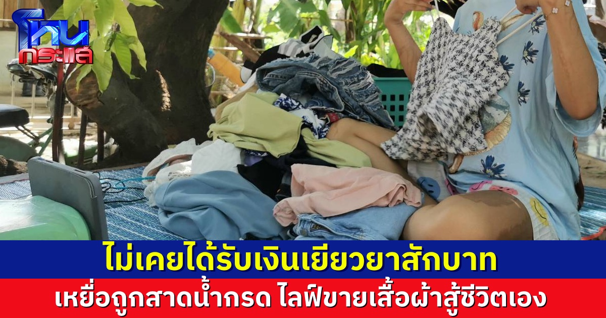 น้อง ม.6 เหยื่อถูกสาดน้ำกรด ไม่ท้อ ไลฟ์ขายเสื้อผ้าหารายได้ช่วยครอบครัว ยังไม่เคยได้รับเงินเยียวยาจากคนทำสักบาทเดียว