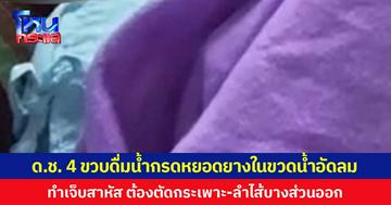 ด.ช.4 ขวบดื่มน้ำกรดหยอดยางในขวดน้ำอัดลม ทำเจ็บสาหัส ต้องตัดกระเพาะ-ลำไส้บางส่วนออก