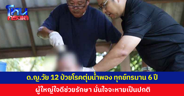 เด็กหญิงวัย 12 ป่วยโรคตุ่มน้ำพอง ทนทุกข์ทรมานนานกว่า 6 ปี  ผู้ใหญ่ใจดีช่วยรักษา