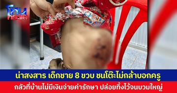 น่าสงสาร เด็กชาย 8 ขวบ ชนโต๊ะไม่กล้าบอกครู กลัวที่บ้านไม่มีเงินจ่ายค่ารักษา ปล่อยทิ้งไว้จนบวมใหญ่
