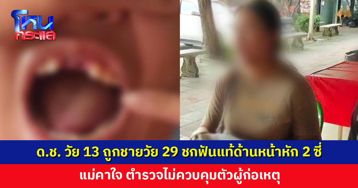 แม่แจ้งความ ลูกชายวัย 13 ปี ถูกชายวัย 29 ปี ชกฟันแท้ด้านหน้าหัก 2 ซี่