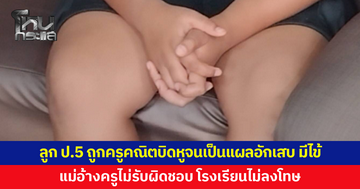 แม่ร้องขอความเป็นธรรม ลูก ป.5 ถูกครูบิดหูจนเป็นแผลอักเสบ มีไข้ แม่อ้างครูไม่รับผิดชอบ ซ้ำ รร.ไม่ลงโทษ