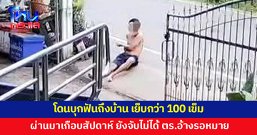 โดนบุกฟันถึงบ้าน เย็บกว่า 100 เข็ม ผ่านมาเกือบสัปดาห์ คนร้ายยังลอยนวล ตร.อ้างต้องรอหมายจับ 