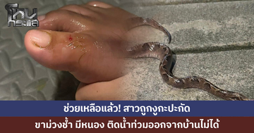 สาวถูกงูกะปะกัดจนขาม่วงช้ำ ติดน้ำท่วม ออกจากบ้านไม่ได้ ล่าสุดได้รับการช่วยเหลือแล้ว