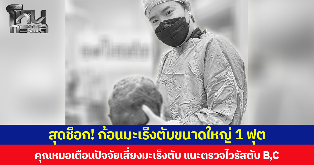 สุดช็อก! เพจ “หมอผ่าตับ” โพสต์ภาพก้อนมะเร็งตับขนาดใหญ่ 1 ฟุต  พร้อมเตือนปัจจัยเสี่ยงมะเร็งตับ แนะตรวจไวรัสตับอักเสบ B,C