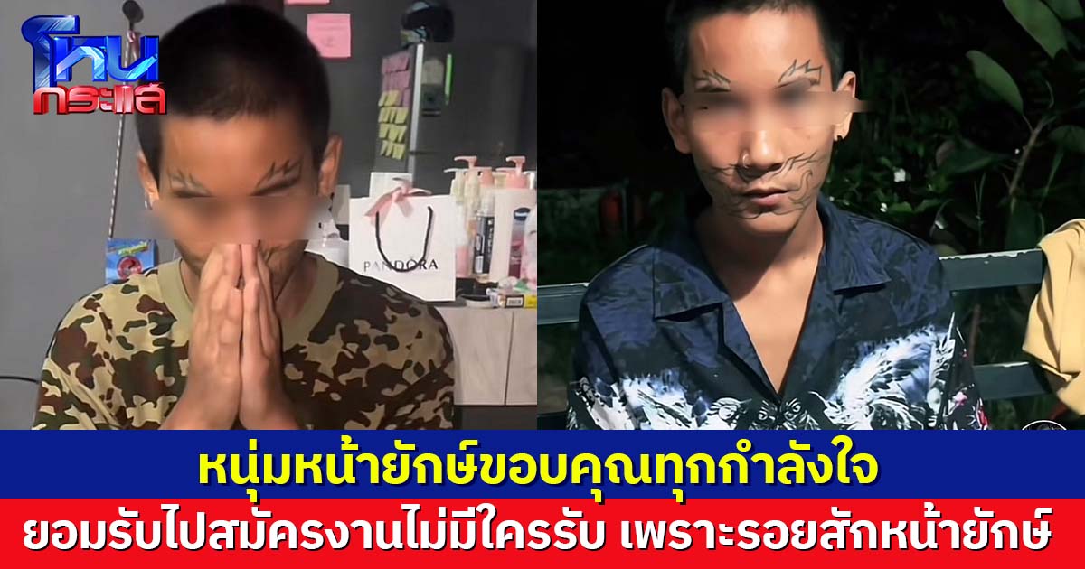 หนุ่มหน้ายักษ์ขอบคุณ หลังมีคลินิกช่วยลบรอยสักให้ รับที่ผ่านมา สมัครงานที่ไหนไม่มีใครรับ 